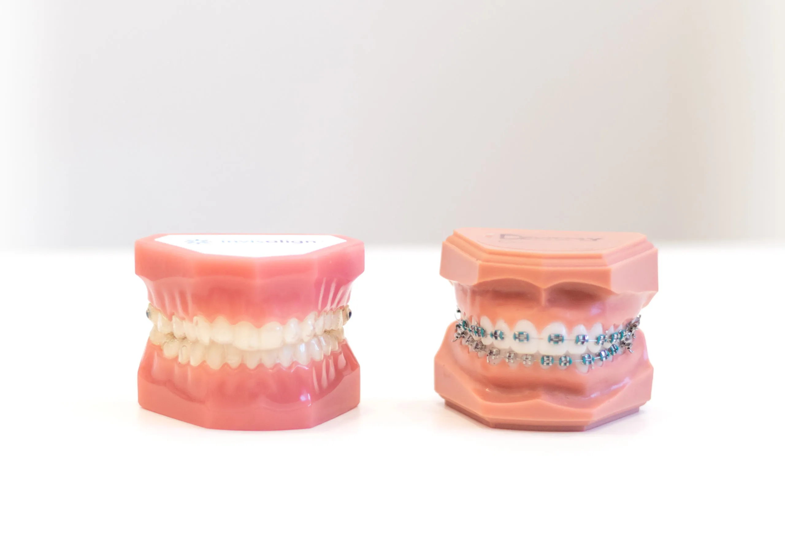 ارتودنسی یا کامپوزیت ؟کدام برای دندان من بهتر است