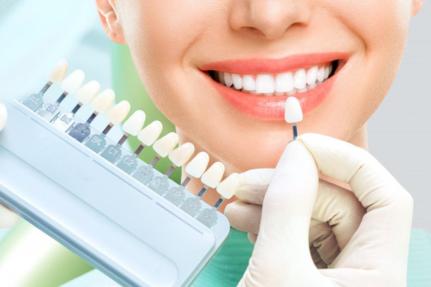 عمل بینی و کامپوزیت دندان ،بهتر است کدام را ابتدا انجام بدیم؟