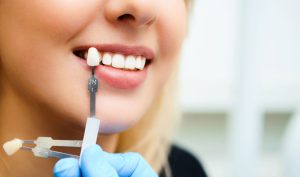 سوالات متداول کامپوزیت دندان و عمل بینی