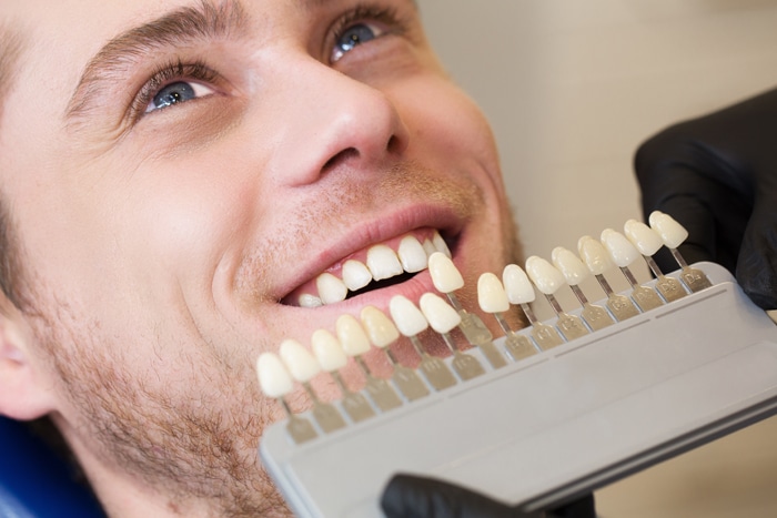 طول عمر کامپوزیت دندان