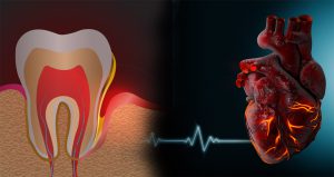 آیا ایمپلنت برای بییماران قلبی امکان پذیر است؟شرایط و نکات و خطرات آن-دکتر بنائیان