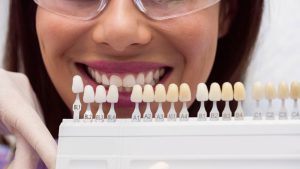 روش‌های جلوگیری از تغییر رنگ کامپوزیت دندان