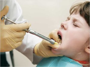 آیا همه روش‌های بی‌حس‌کننده دندان عوارض دارند؟