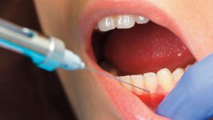 ضرورت بی حسی دندان چیست؟
