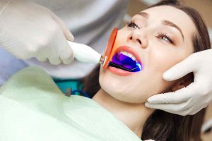 سلاح لیزری برای از بین‌ بردن باکتری‌های دندان