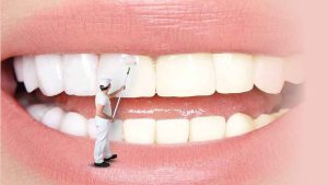 سفیدکردن دندان‌ها بدون مسواک