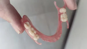 2- دندان مصنوعی پارسیل اکریلیک