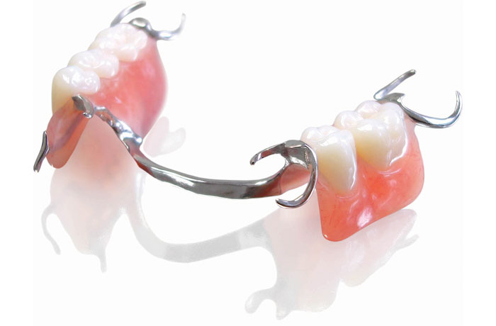 3- دندان مصنوعی فلیپر با پایه فلزی