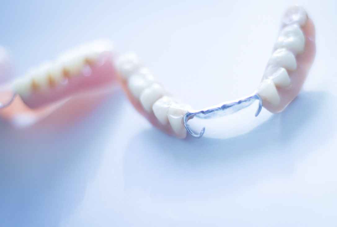 دندان مصنوعی تکه‌ای چیست؟ مهمترین مزایا و معایب دندان مصنوعی پارسیل