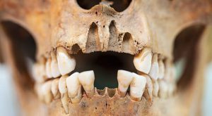 توجه به سلامت دندان‌ها در اسکاندیناوی