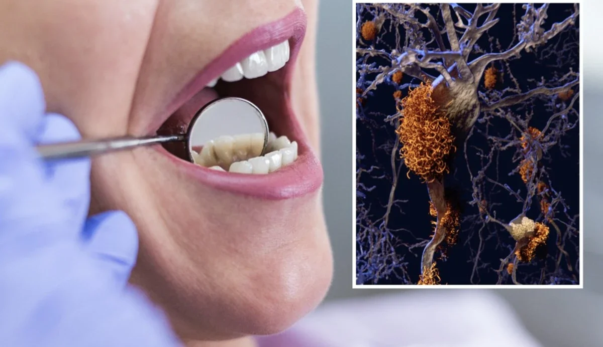 تشخیص آلزایمر از طریق دهان و دندان