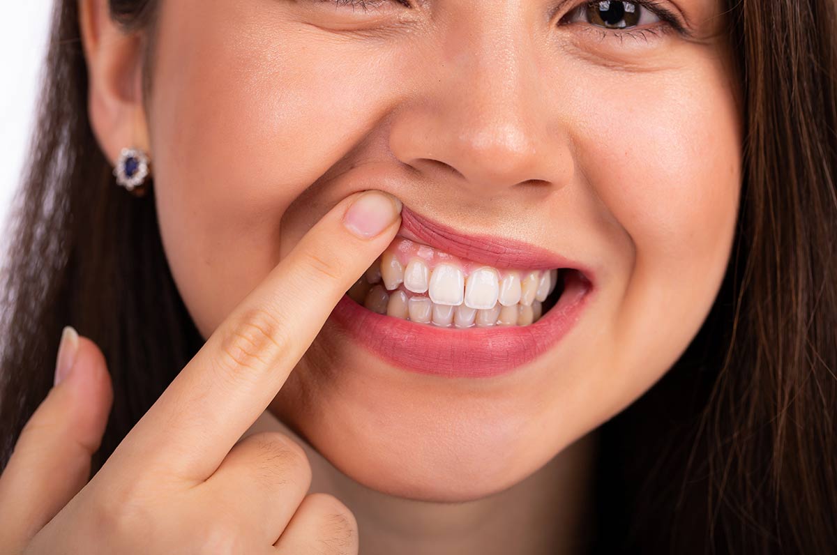 آیا کامپوزیت دندان ضرر دارد؟ روش‌های پیشگیری از عوارض کامپوزیت